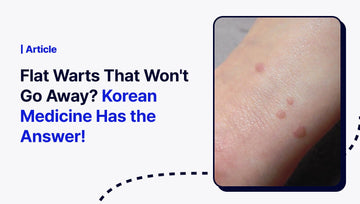Flat Warts That Won't Go Away? Korean Medicine Has the Answer! - The Pylon Square