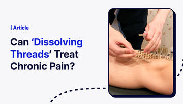 Can ‘Dissolving Thread Embedding’ Treat Chronic Pain? - The Pylon Square