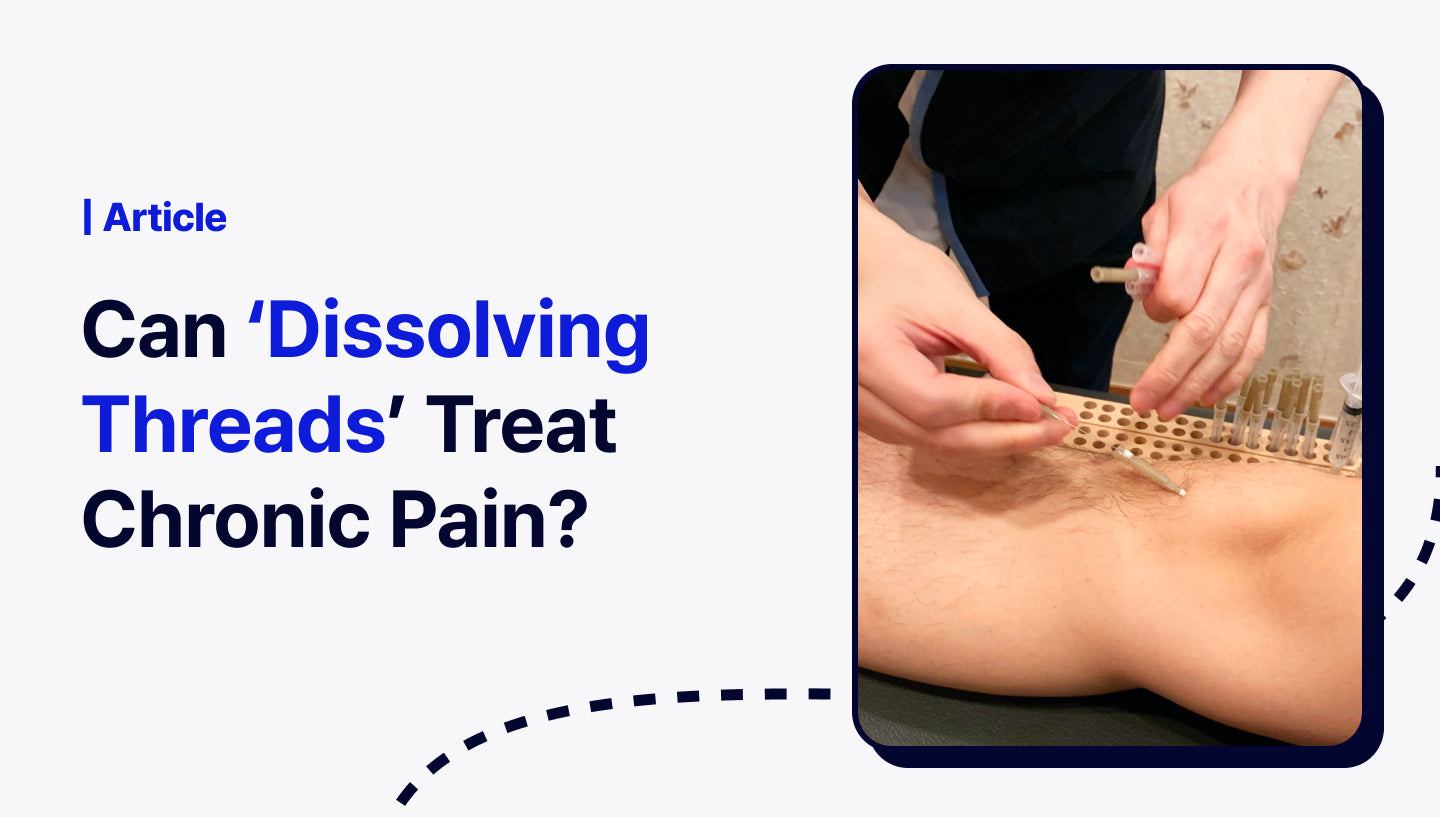 Can ‘Dissolving Thread Embedding’ Treat Chronic Pain?
