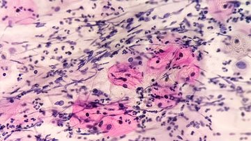 Inflammatory Bowel Disease: What Is IBD, Crohn's Disease, and Ulcerative Colitis — Why There's No Cure Yet