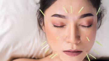 Korean Cosmetic Acupuncture: Why European Doctors Are Taking Notes