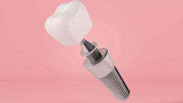 4 Things That Can Stand in the Way of a Dental Implant