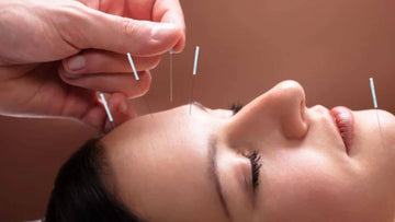 Facial Rejuvenation Acupuncture in Korea: Jeonganchim Works From the Inside Out