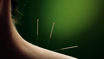 Needle Phobia? You May Still Be Able to Get Acupuncture