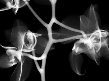 Orthopedics & Neurosurgery