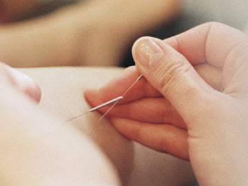 Traditional Korean Medicine