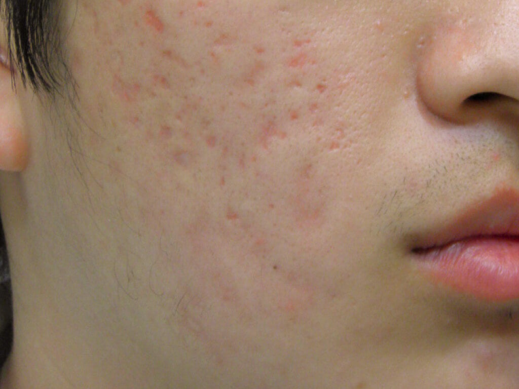 image comparison after