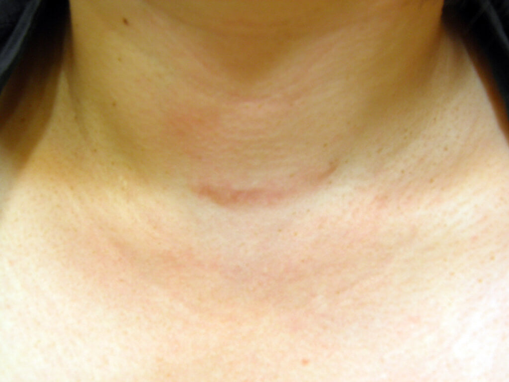 image comparison after