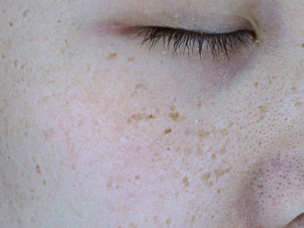 image comparison before