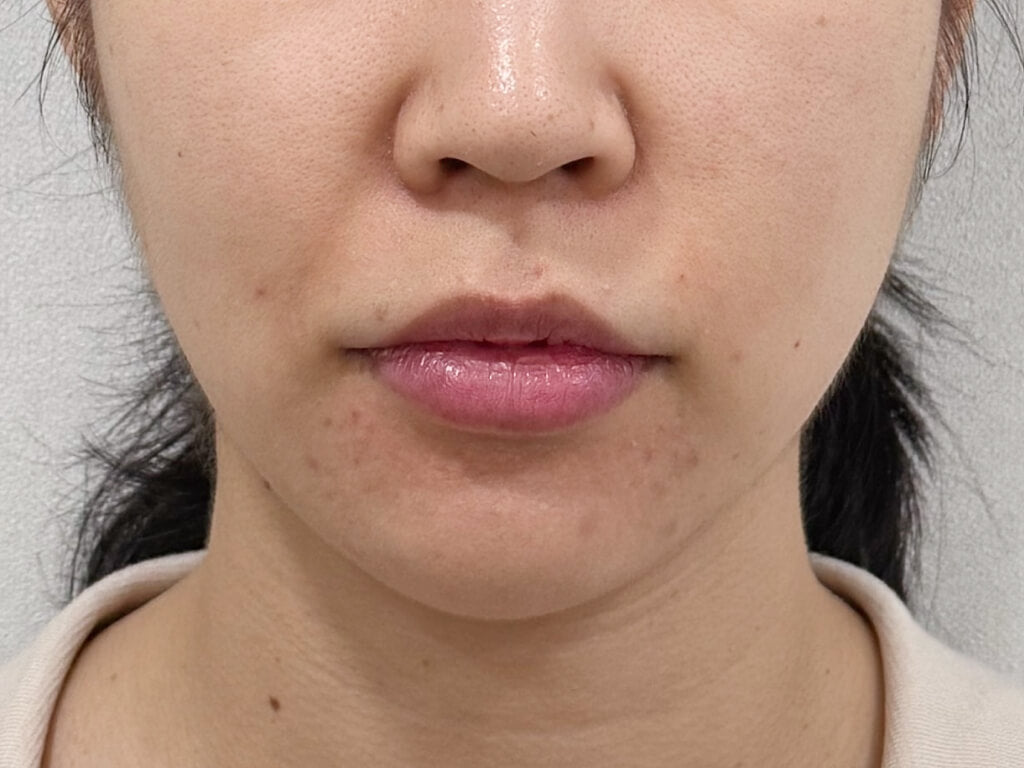 image comparison before