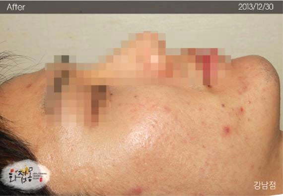 image comparison after