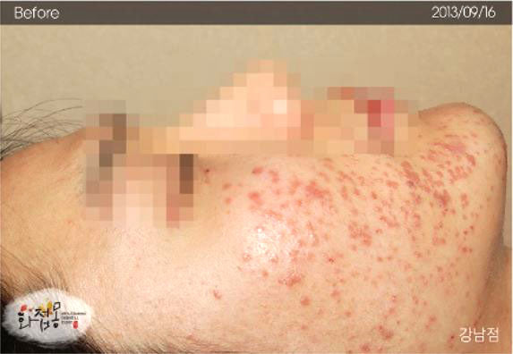 image comparison before