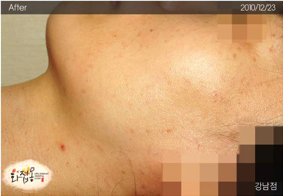 image comparison after