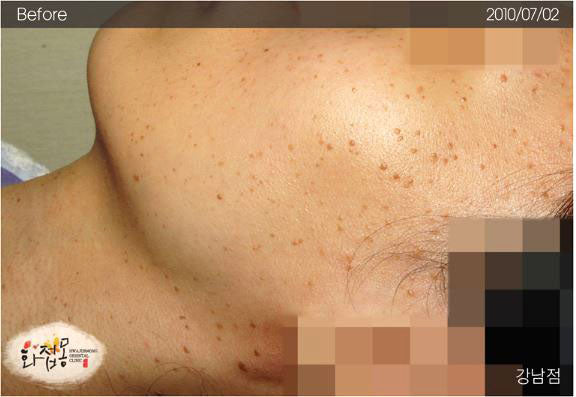 image comparison before