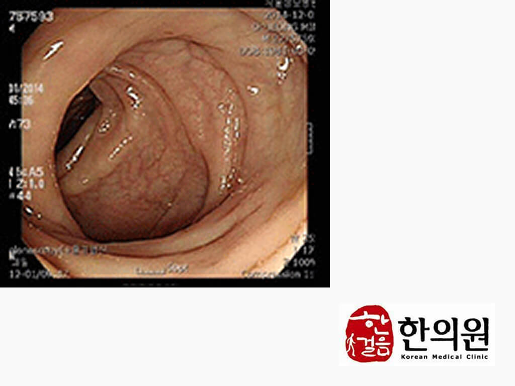 image comparison after