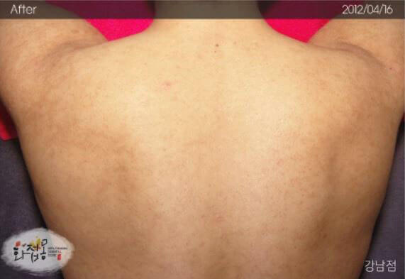 image comparison after