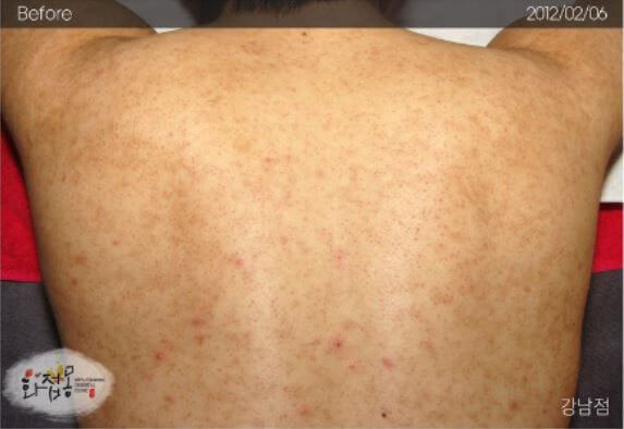 image comparison before