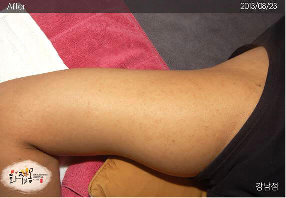 image comparison after