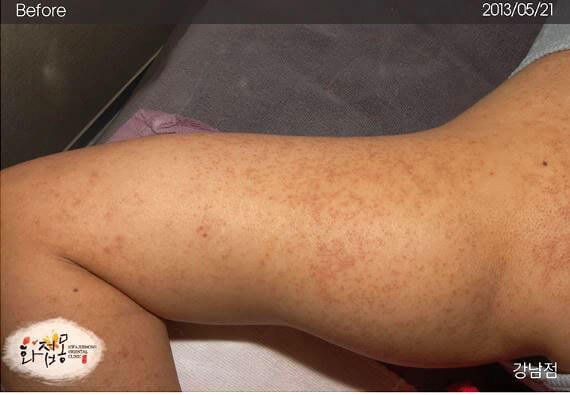 image comparison before