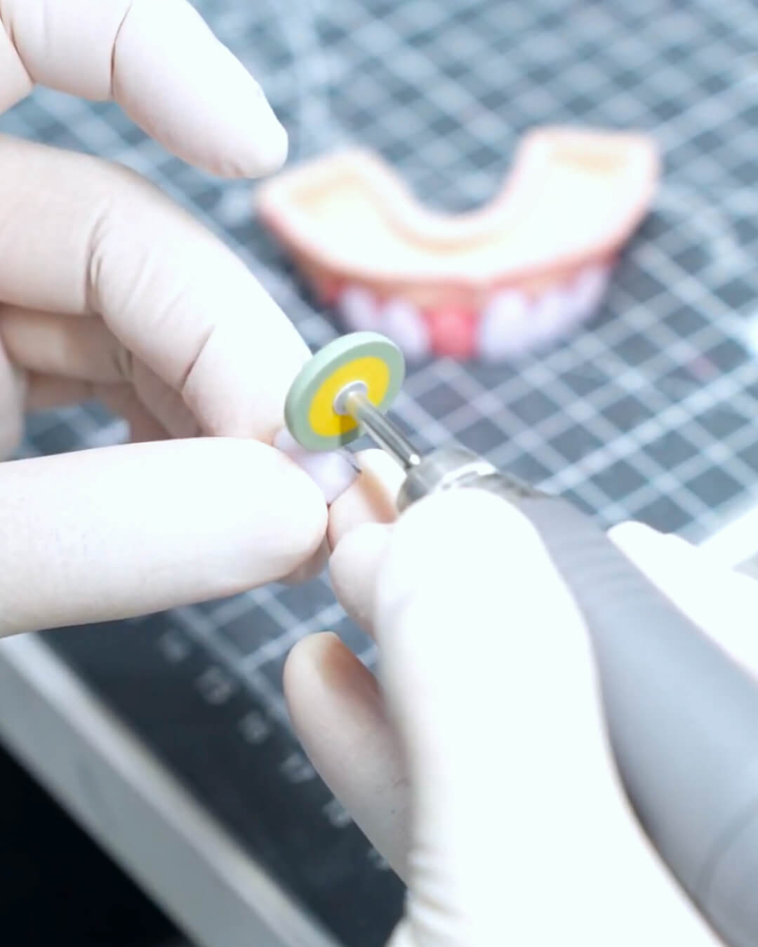Lucid Dental Clinic | One-Day Veneer & Age-Tailored Orthodontics