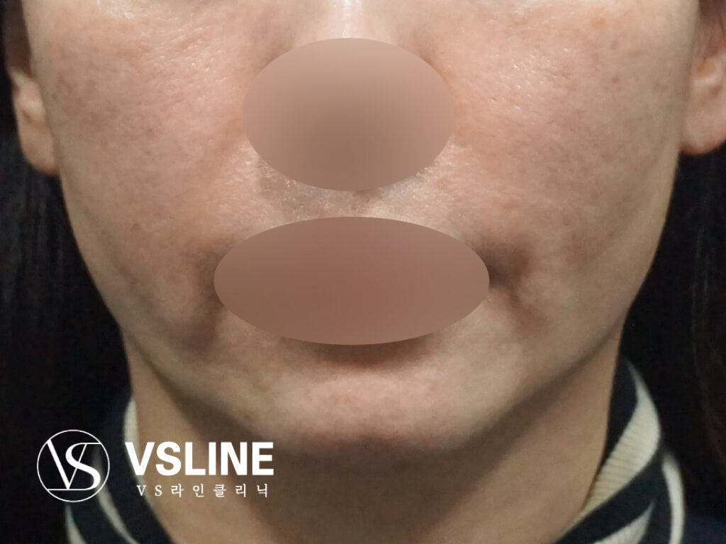 image comparison before