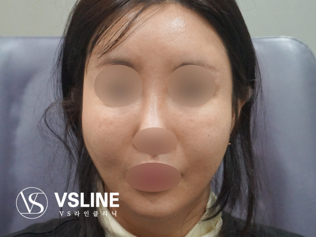 image comparison before