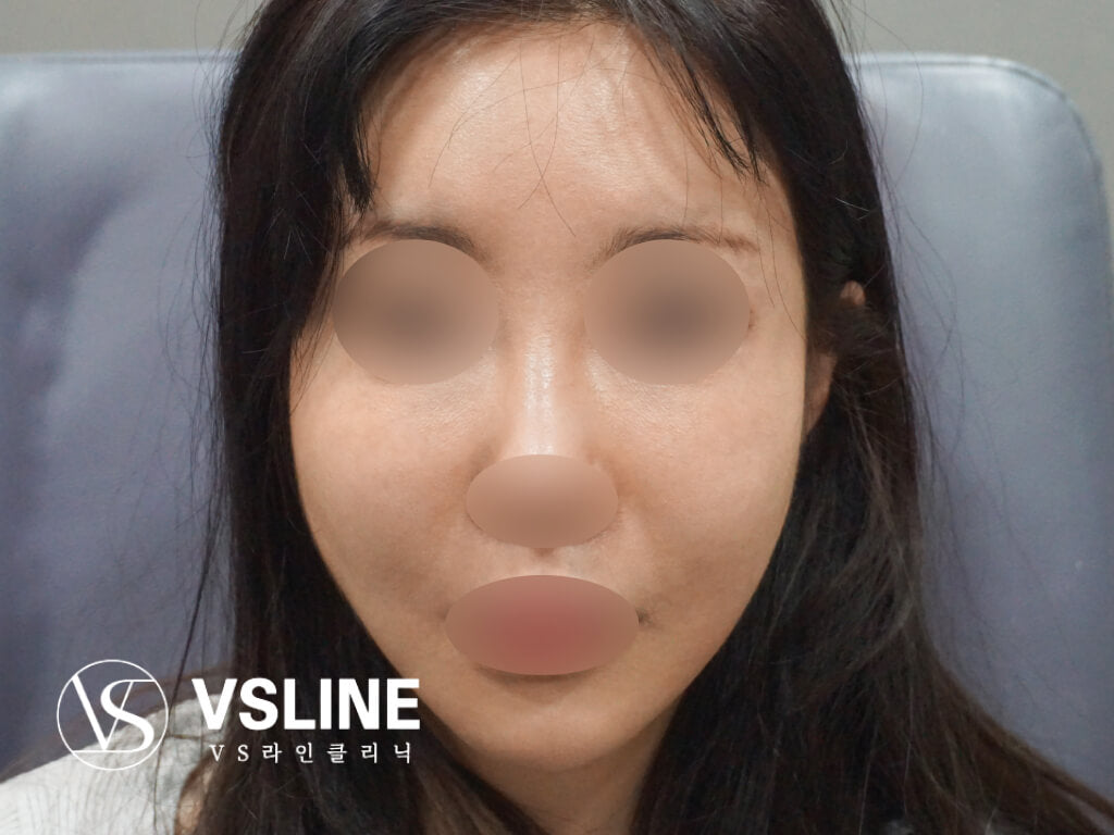 image comparison after