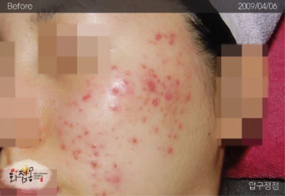 image comparison before