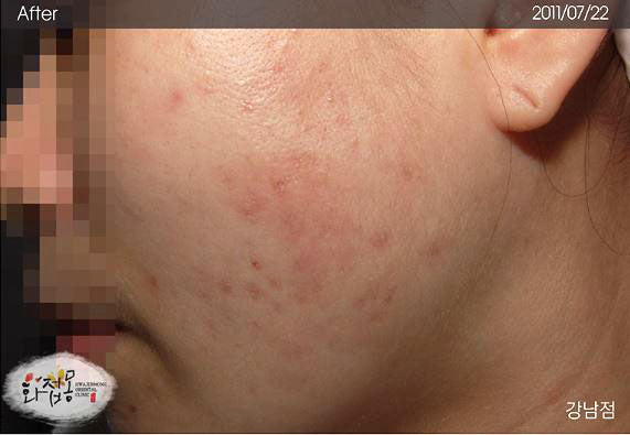 image comparison after