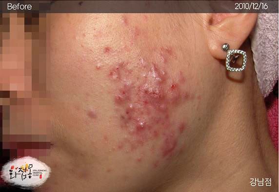 image comparison before